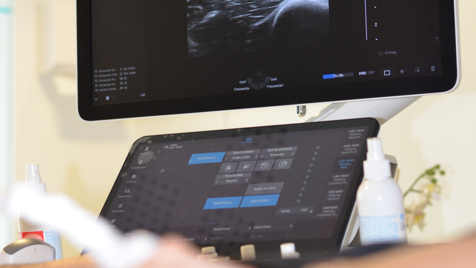 Imagen de una ecografía musculoesquelética en Aner Fisioterapia, utilizada como apoyo al diagnóstico y seguimiento de lesiones. Nuestro equipo combina la valoración individualizada con tecnología avanzada para ofrecer un tratamiento personalizado en Zizur Mayor y Huarte, cerca de Pamplona.
